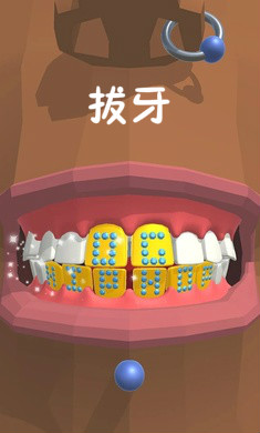 拔牙游戏下载