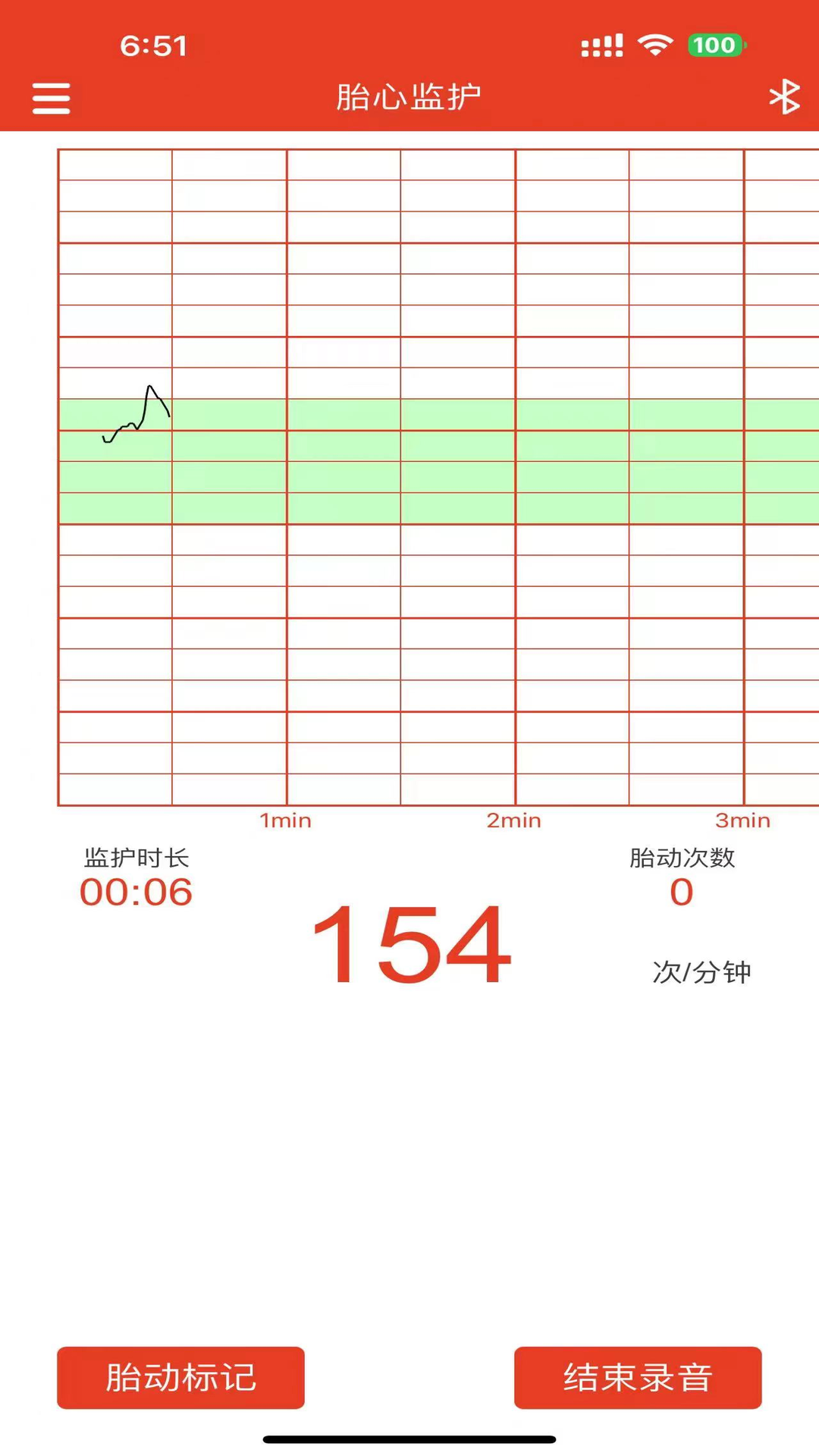 左点胎心仪app下载安装_左点胎心仪应用安卓版v1.7